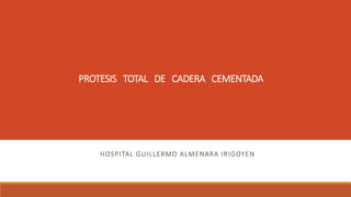 PROTESIS TOTAL DE CADERA CEMENTADA
HOSPITAL GUILLERMO ALMENARA IRIGOYEN
 