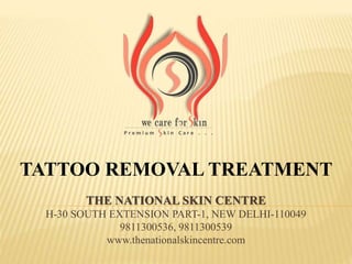 THE NATIONAL SKIN CENTRE
H-30 SOUTH EXTENSION PART-1, NEW DELHI-110049
9811300536, 9811300539
www.thenationalskincentre.com
TATTOO REMOVAL TREATMENT
 