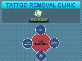 Arijai
Aesthetics
BBL
Fungus
Removal
Skin
care
Tattoo
Removal
952-435-0605
 