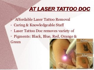 Laser Tattoo Removal in Los Angeles  ZendyHealth  Save 2080