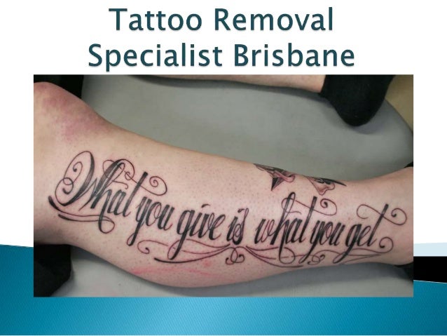find the best tattoo removal clinic for easy tattoo removal in less s u2026 find the best tattoo removal clinic for easy tattoo removal in less s u2026