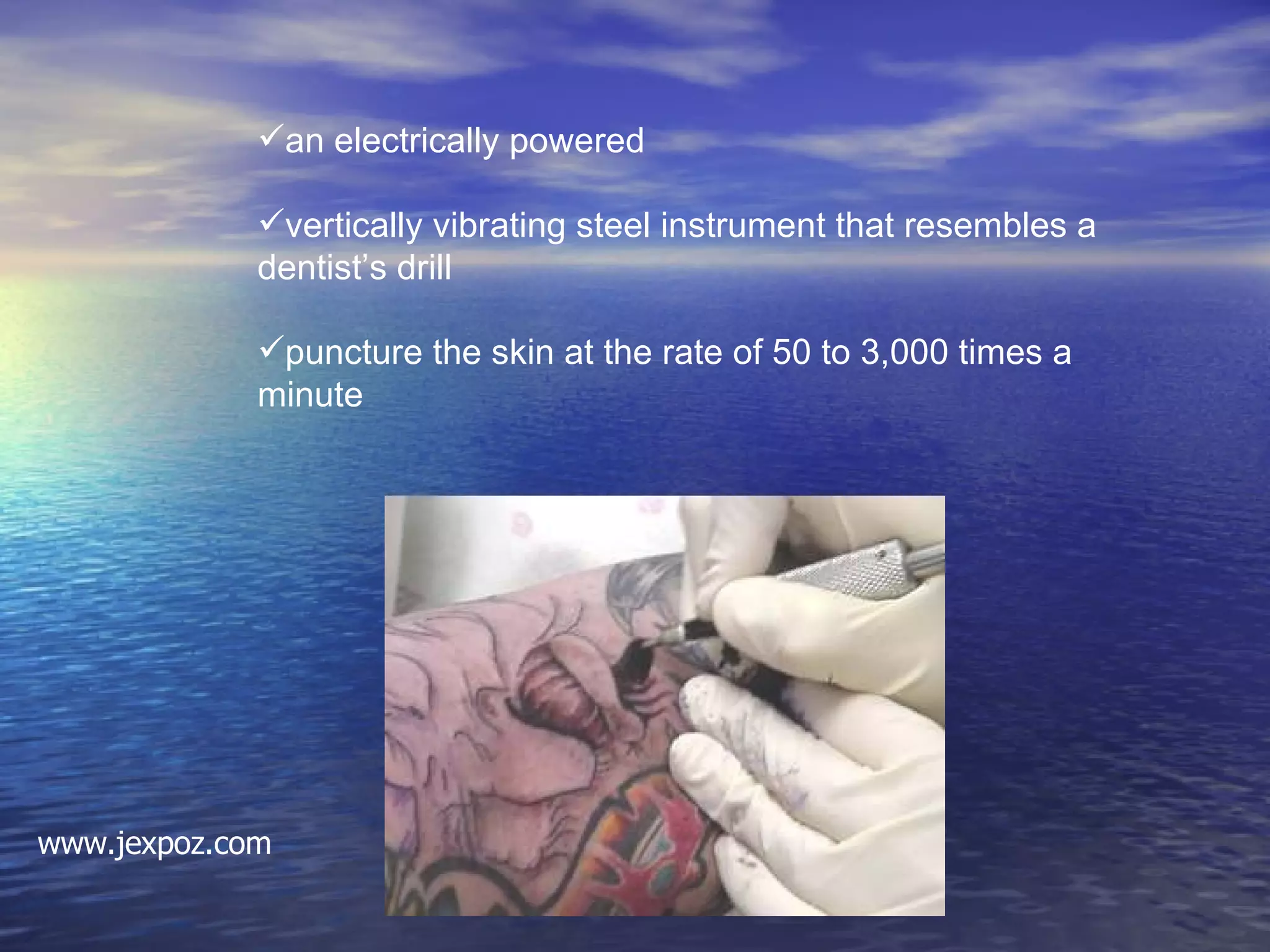 an electrically powered vertically vibrating steel instrument that resembles a dentist’s drill  puncture the skin at the rate of 50 to 3,000 times a minute www.jexpoz.com 