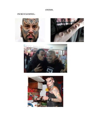 ANEXOS.

INCRUSTACIONES.-
 