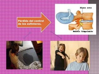 Pérdida del control
de los esfínteres.
 