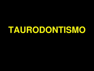 Taurodontismo - Anomalias Dentarias