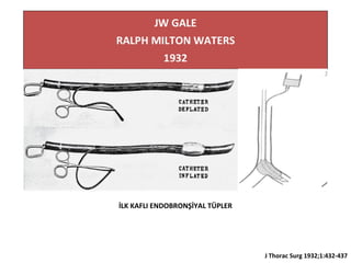 İLK KAFLI ENDOBRONŞİYAL TÜPLER
J Thorac Surg 1932;1:432-437
 