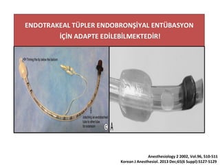 Anesthesiology 2 2002, Vol.96, 510-511
Korean J Anesthesiol. 2013 Dec;65(6 Suppl):S127-S129
 