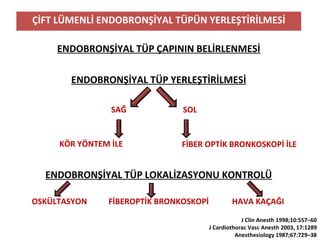 ÇİFT LÜMENLİ ENDOBRONŞİYAL TÜPÜN YERLEŞTİRİLMESİ
ENDOBRONŞİYAL TÜP ÇAPININ BELİRLENMESİ
ENDOBRONŞİYAL TÜP YERLEŞTİRİLMESİ
SAĞ SOL
KÖR YÖNTEM İLE FİBER OPTİK BRONKOSKOPİ İLE
ENDOBRONŞİYAL TÜP LOKALİZASYONU KONTROLÜ
OSKÜLTASYON FİBEROPTİK BRONKOSKOPİ HAVA KAÇAĞI
J Clin Anesth 1998;10:557–60
J Cardiothorac Vasc Anesth 2003, 17:1289
Anesthesiology 1987;67:729–38
 
