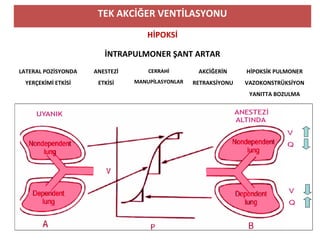TEK AKCİĞER VENTİLASYONU
HİPOKSİ
İNTRAPULMONER ŞANT ARTAR
LATERAL POZİSYONDA
YERÇEKİMİ ETKİSİ
ANESTEZİ
ETKİSİ
CERRAHİ
MANUPİLASYONLAR
AKCİĞERİN
RETRAKSİYONU
HİPOKSİK PULMONER
VAZOKONSTRÜKSİYON
YANITTA BOZULMA
 