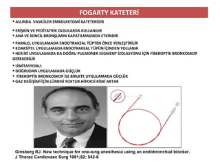 FOGARTY KATETERİ
 ASLINDA VASKÜLER EMBOLEKTOMİ KATETERİDİR
 ERİŞKİN VE PEDİYATRİK OLGULARDA KULLANILIR
 ANA VE İKİNCİL BRONŞLARIN KAPATILMASINDA ETKİNDİR
 PARALEL UYGULAMADA ENDOTRAKEAL TÜPTEN ÖNCE YERLEŞTİRİLİR
 KOAKSİYEL UYGULAMADA ENDOTRAKEAL TÜPÜN İÇİNDEN YOLLANIR
 HER İKİ UYGULAMADA DA DOĞRU PULMONER SEGMENT İZOLASYONU İÇİN FİBEROPTİK BRONKOSKOP
GEREKEBİLİR
 LİMİTASYONU:
 DOĞRUDAN UYGULAMADA GÜÇLÜK
 FİBEROPTİK BRONKOSKOP İLE BİRLKTE UYGULAMADA GÜÇLÜK
 GAZ DEĞİŞİMİ İÇİN LÜMENİ YOKTUR.HİPOKSİ RİSKİ ARTAR
Ginsberg RJ. New technique for one-lung anesthesia using an endobronchial blocker.
J Thorac Cardiovasc Surg 1981;82: 542-6
 