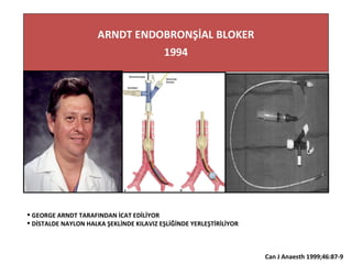 Can J Anaesth 1999;46:87-9H
 GEORGE ARNDT TARAFINDAN İCAT EDİLİYOR
 DİSTALDE NAYLON HALKA ŞEKLİNDE KILAVIZ EŞLİĞİNDE YERLEŞTİRİLİYOR
 