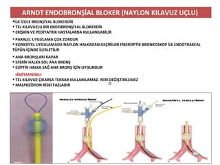 o
ARNDT ENDOBRONŞİAL BLOKER (NAYLON KILAVUZ UÇLU)
İLK İZOLE BRONŞİYAL BLOKERDİR
 TEL KILAVUZLU BİR ENDOBRONŞİYAL BLOKERDİR
 ERİŞKİN VE PEDİYATRİK HASTALARDA KULLANILABİLİR
 PARALEL UYGULAMA ÇOK ZORDUR
 KOAKSİYEL UYGULAMADA NAYLON HALKADAN GEÇİRİLEN FİBEROPTİK BRONKOSKOP İLE ENDOTRAKEAL
TÜPÜN İÇİNDE İLERLETİLİR
 ANA BRONŞLARI KAPAR
 SFERİK HALKA SOL ANA BRONŞ
 ELİPTİK HALKA SAĞ ANA BRONŞ İÇİN UYGUNDUR
LİMİTASYONU:
 TEL KILAVUZ ÇIKARSA TEKRAR KULLANILAMAZ. YERİ DEĞİŞTİRİLEMEZ
 MALPOZİSYON RİSKİ FAZLADIR
 
