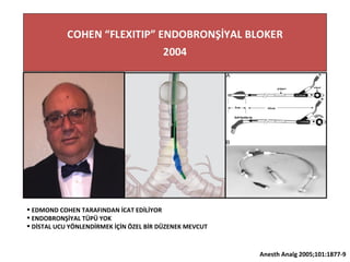 Anesth Analg 2005;101:1877-9
 EDMOND COHEN TARAFINDAN İCAT EDİLİYOR
 ENDOBRONŞİYAL TÜPÜ YOK
 DİSTAL UCU YÖNLENDİRMEK İÇİN ÖZEL BİR DÜZENEK MEVCUT
 