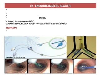 EZ ENDOBRONŞİYAL BLOKER



 ÖNDÜRÜ
 DAHA AZ MALPOZİSYON GÖRÜLÜ
GEREKTİREN DURUMLARDA REPOZİSYON GEREK TİRMEDEN KULLANILABİLİR
DEZAVANTAJ

Anesth 2012;26:375-80
 