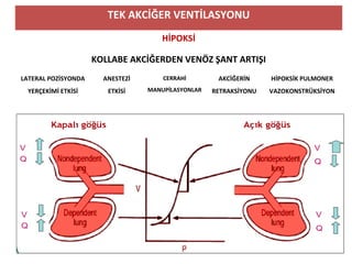 TEK AKCİĞER VENTİLASYONU
HİPOKSİ
KOLLABE AKCİĞERDEN VENÖZ ŞANT ARTIŞI
LATERAL POZİSYONDA
YERÇEKİMİ ETKİSİ
ANESTEZİ
ETKİSİ
CERRAHİ
MANUPİLASYONLAR
AKCİĞERİN
RETRAKSİYONU
HİPOKSİK PULMONER
VAZOKONSTRÜKSİYON
 