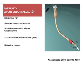 PAPWORTH
BiVENT ENDOTRAKEAL TÜP
ÇİFT LÜMENLİ TÜP
LÜMENLER KARİNAYA OTURUYOR
ENDOBRONŞİYAL BLOKER İÇİNDEN
YERLEŞTİRİLİYOR
TEK LÜMENLİ GÖRÜNTÜSÜNDE UCU ÇATALLI
P3 Medical Limited
Anaesthesia, 2008, 63: 996–1000
 