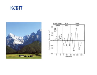 Auditory brainstem
   responses
 