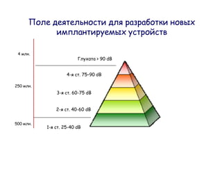 4    .
                                      > 90 dB


                        4-   . 75 90 dB

250       .
                   3-    . 60-75 dB


                   2-   . 40-60 dB


500       .
              1-    . 25-40 dB
 