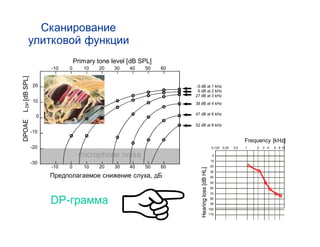 Primary tone level [dB SPL]
                      -10   0      10   20    30   40   50    60
L DP [dB SPL]




                20                                                 -5 dB at 1 kHz
                                                                    6 dB at 2 kHz
                                                                   27 dB at 3 kHz
                10                                                 38 dB at 4 kHz

                                                                   47 dB at 6 kHz
                  0
DPOAE




                                                                   52 dB at 8 kHz
                -10
                                                                                                                   Frequency [kHz]
                -20                                                                           0,125   0,25   0,5   1   2   3 4     6 8 10

                                 microphone noise                                              0
                                                                                              10
                -30
                      -10   0      10   20    30   40   50    60                              20                   £




                                                                      Hearing loss [dB HL]
                                                                                              30                       £
                                                          ,                                   40
                                                                                              50                           £
                                                                                              60                               £
                                                                                              70                                   ££

                      DP-                                                                     80
                                                                                              90
                                                                                             100
                                                                                             110
 