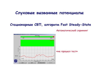 C

    ,       Fast Steady-State




        «           »
 