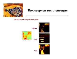 ___________________


  SPEAK




    CIS




   ACE
 