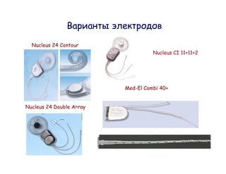 Nucleus 24 Contour
                                    Nucleus CI 11+11+2




                          Med-El Combi 40+


Nucleus 24 Double Array
 