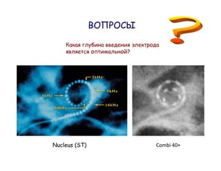 ?




Nucleus (ST)       Combi 40+
 