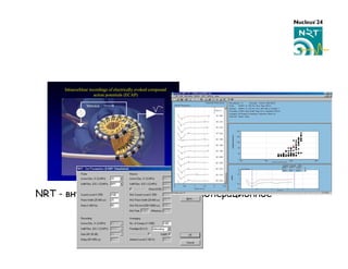 Intracochlear recordings of electrically evoked compound
                         action potentials (ECAP)

                    Stimulus




NRT -
 