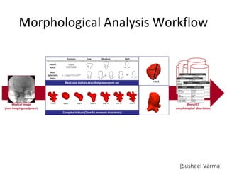 Medical image
from imaging equipment
@neurIST
morphological descriptors
Complex indices (Zernike moment invariants)
Basic size indices describing aneurysm sac
depth
neck
Morphological Analysis Workflow
[Susheel Varma]
 