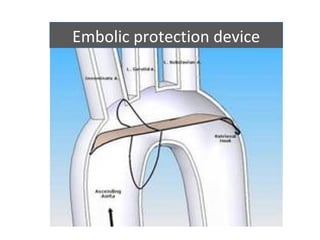 Embolic protection device
 