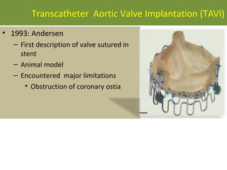 Transcatheter Aortic Valve Implantation (TAVI)
• 1993: Andersen
  – First description of valve sutured in
    stent
  – Animal model
  – Encountered major limitations
      • Obstruction of coronary ostia
 