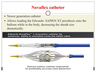 Novaflex catheter
 Newer generation catheter
 Allows loading the Edwards- SAPIEN XT prosthesis onto the
balloon while in the body, decreasing the sheath size
dramatically.
 