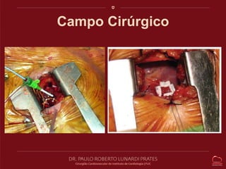 Campo Cirúrgico 
 
