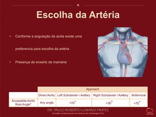 Escolha da Artéria 
• Conforme a angulação da aorta existe uma 
preferencia para escolha da artéria 
• Presença de enxerto de mamária 
Approach 
Direct Aortic Left Subclavian / Axillary Right Subclavian / Axillary Iliofemoral 
Acceptable Aortic 
Root Angle* 
Any angle <70° <30° <70° 
 