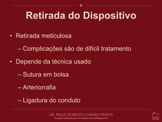 Retirada do Dispositivo 
• Retirada meticulosa 
– Complicações são de difícil tratamento 
• Depende da técnica usado 
– Sutura em bolsa 
– Arteriorrafia 
– Ligadura do conduto 
 
