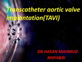 Transcatheter aortic valve
implantation(TAVI)
DR.HASAN MAHMUD
NHFH&RI
 