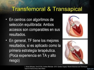 Transfemoral & Transapical
• En centros con algoritmos de
selección equilibrada: Ambos
accesos son comparables en sus
resultados.
• En general, TF tiene los mejores
resultados, si es aplicado como la
primera estrategia terapéutica.
(Poca experiencia en TA y alto
riesgo)
1. Narain Moorjani, Sunil K Ohri, Andrew Wechsler. 2013. Cardiac Surgery: Recent Advances and Techniques.
Taylor & Francis Group. Boca Raton.
 