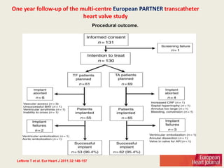 One year follow-up of the multi-centre European PARTNER transcatheter
                           heart valve study
                                                Procedural outcome.




 Lefèvre T et al. Eur Heart J 2011;32:148-157
 