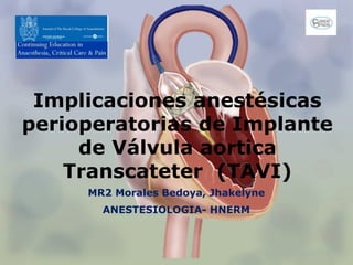 Implicaciones anestésicas
perioperatorias de Implante
de Válvula aortica
Transcateter (TAVI)
MR2 Morales Bedoya, Jhakelyne
ANESTESIOLOGIA- HNERM
 
