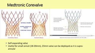 TAVI - Transcatheter Aortic Valve Implantation | PPTX