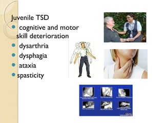 Juvenile TSD
 cognitive and motor
skill deterioration
 dysarthria
 dysphagia
 ataxia
spasticity

 