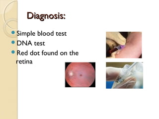 Diagnosis:
Simple

blood test
DNA test
Red dot found on the
retina

 