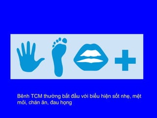 Bênh TCM thường bắt đầu với biểu hiện sốt nhẹ, mệt
mỏi, chán ăn, đau họng
 