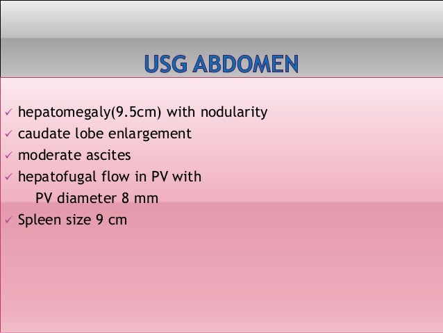 A Case Of Ascites And Hepatomegaly