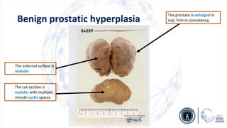 P2) Morphology of Renal & Male system.pdf
