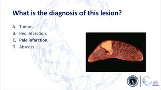 Rd Infraction Example P2) Morphology of Renal & Male system.pdf