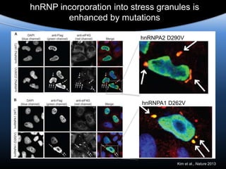 hnRNP incorporation into stress granules is
enhanced by mutations
hnRNPA2 D290V
hnRNPA1 D262V
Kim et al., Nature 2013
 