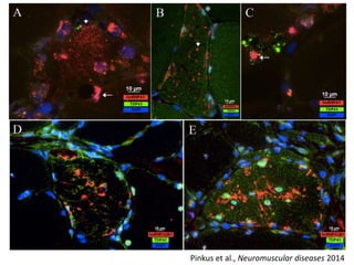 Pinkus et al., Neuromuscular diseases 2014
 