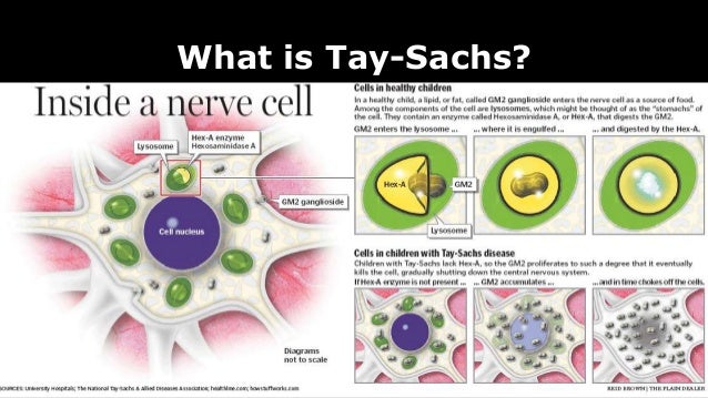 an overview of tay sachs disease in children and the death in five years an overview of tay sachs disease in children and the death in five years