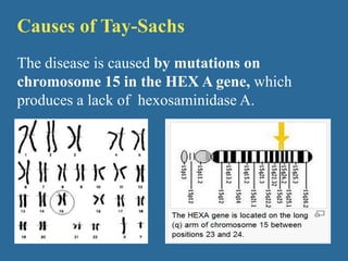 Without this enzyme, gangliosides, particularly ganglioside GM2, increases and degenerates central nervous system.